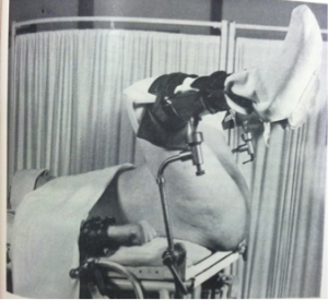 Lithotomy-Then-300x275